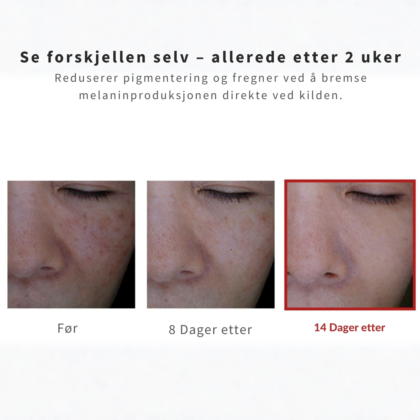 Slutt å dekke til. Begynn å leve. 