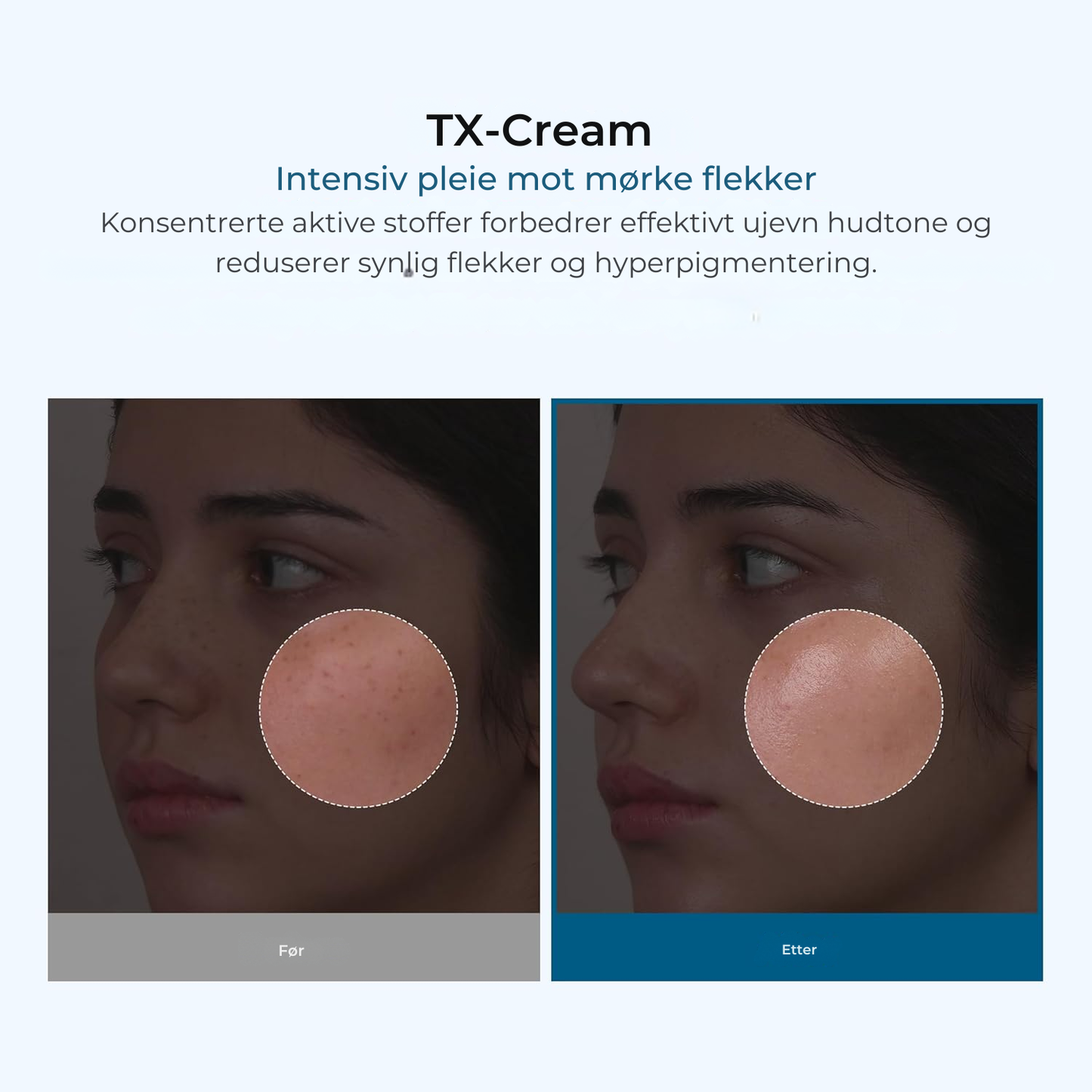 Slutt å dekke til. Begynn å leve. 