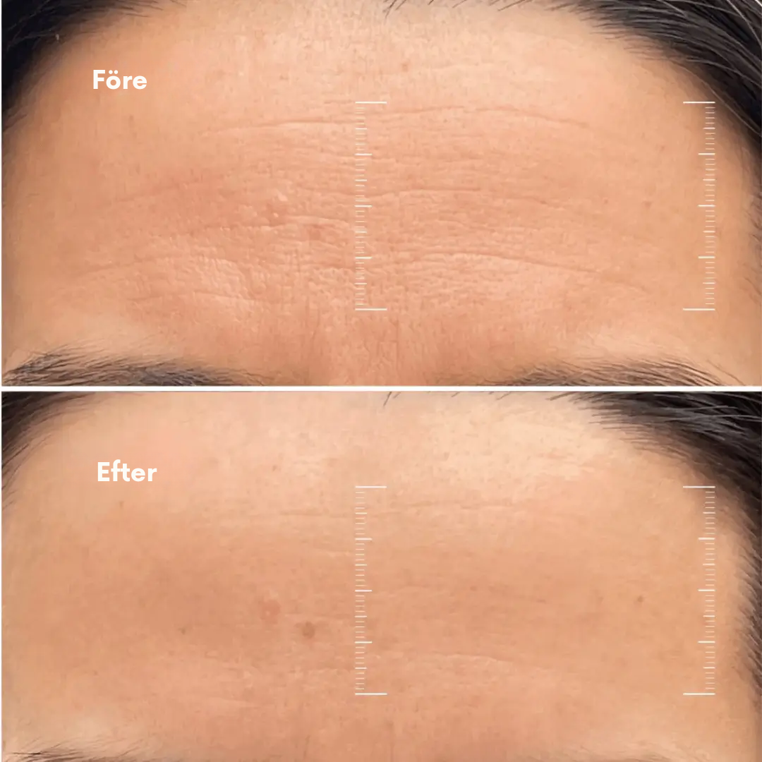 Baseline Age Reverse Cream
