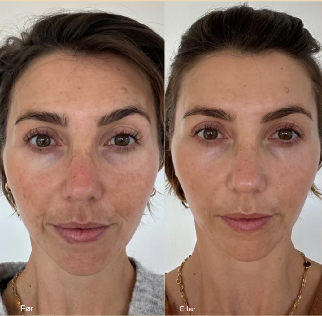 BASELINE Age Reverse Cream – Synlig yngre hud. Uten irritasjon.