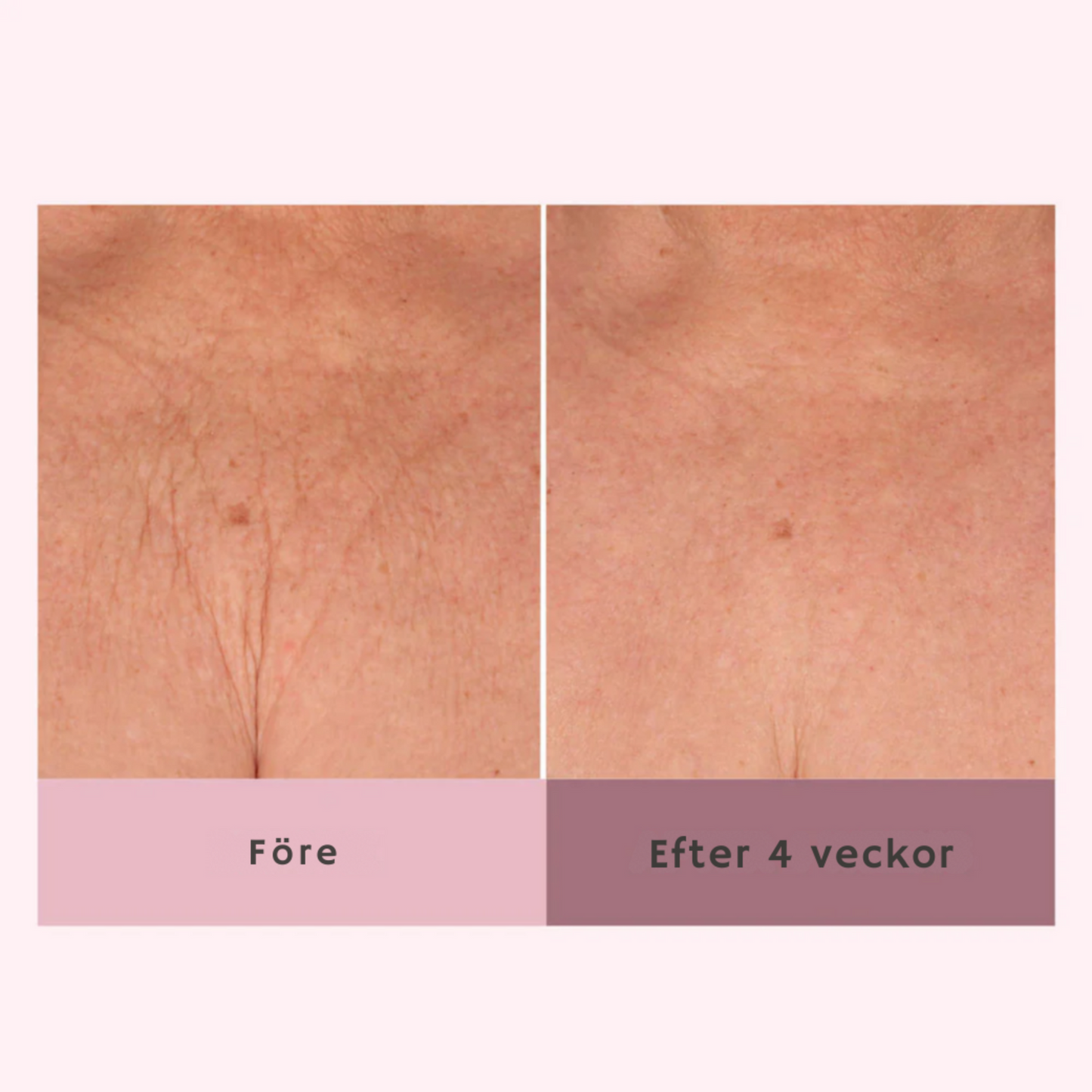 Baseline - Body Firming Crème