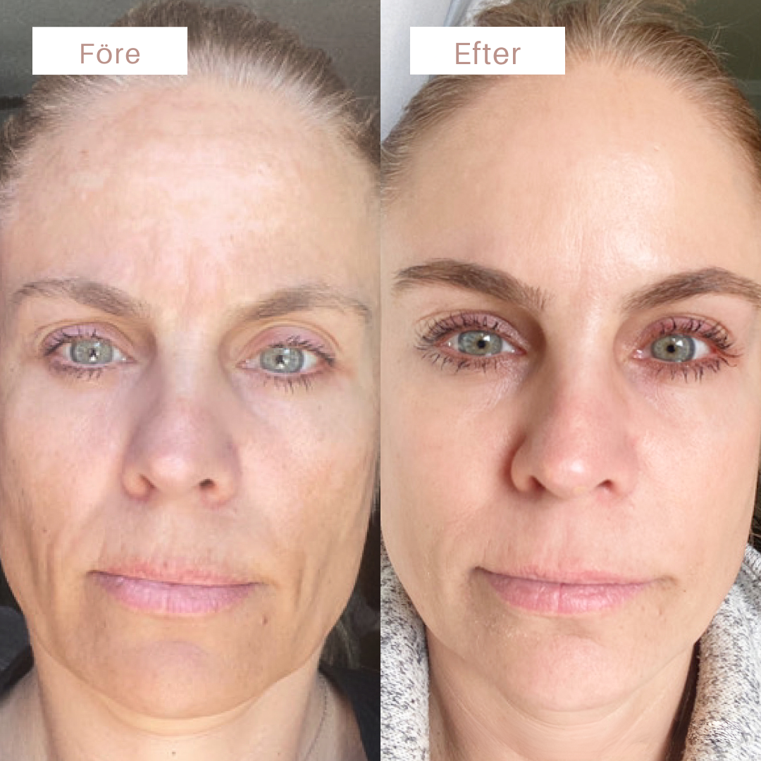 Baseline Age Reverse Cream